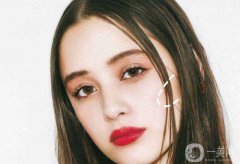 削骨要多少錢 削骨果好不好