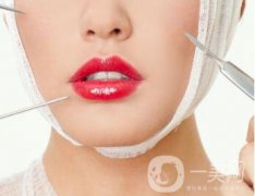 面部吸脂減肥價格 面部吸脂多久消腫