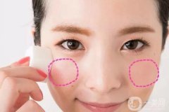 臉頰隆起的原因是什么 手術怎么做？