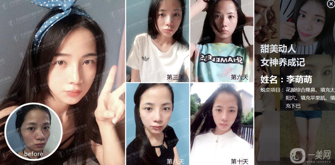 成都武侯區(qū)艾米麗醫(yī)療美容門(mén)診部