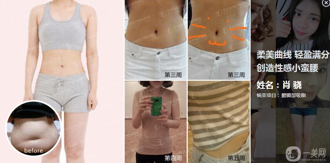 成都武侯區(qū)艾米麗醫(yī)療美容門(mén)診部
