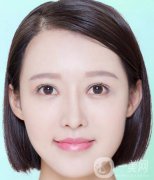 去紅色胎記留疤嗎？有哪些方法可以去胎記呢？