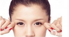 祛皺多少錢 皺紋的去除費(fèi)用 玻尿酸除皺好不好