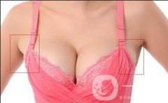 去副乳貴嗎？大概多少錢？