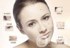 自體脂肪面部填充貴嗎？多少錢(qián)？