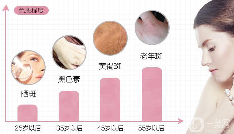 如何調(diào)節(jié)老年斑 都有哪些方式呢？