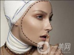 磨骨整形貴嗎？大概多少錢？