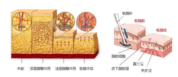 上海九院*價(jià)格 上海九院好不好