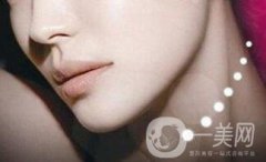 膨體墊下巴貴嗎？大概多少錢？