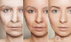 抗衰老除皺的調(diào)節(jié)方式有哪些呢？