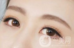 韓式三點(diǎn)雙眼皮價(jià)格是多少？和埋線雙眼皮的區(qū)別？