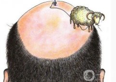 過(guò)早脫發(fā)如何調(diào)節(jié) 調(diào)節(jié)脫發(fā)哪種方比較好?