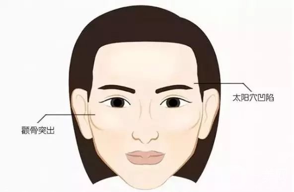 顴骨內(nèi)推貴嗎 顴骨內(nèi)推*果好不好