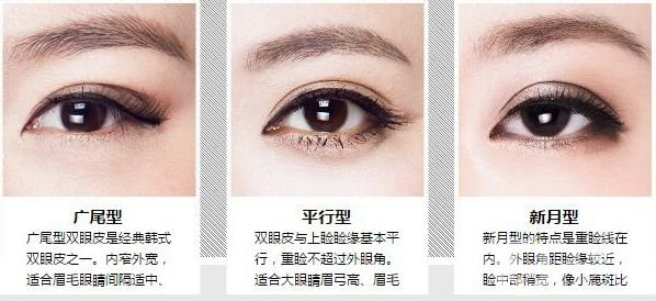 腫泡眼雙眼皮貴嗎 腫泡眼雙眼皮手術的價格