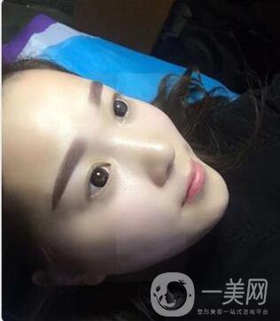 繡眉的價格是多少 繡眉*果圖