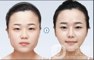 *要多少錢
