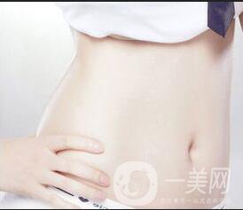 腹壁成形術(shù)風(fēng)險(xiǎn),腹壁成形術(shù)注意事項(xiàng)