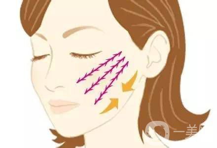 埋線面部提升多久恢復(fù) 術(shù)后如何護(hù)理？
