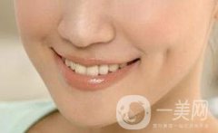 人造酒窩前后照片一覽？大概要多少錢？