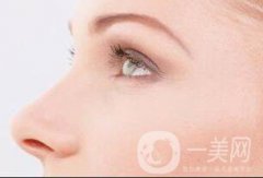 北京駝峰鼻矯正好嗎?果怎么樣?