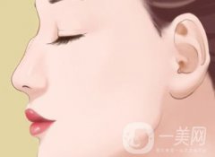 駝峰鼻手術(shù)價(jià)格一般是多少？