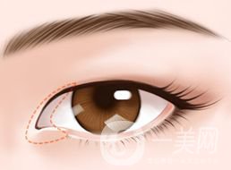 開眼角的*果怎么樣 好不好？
