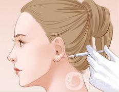 注射玻尿酸豐耳垂前后 豐耳垂果好不好？