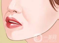 自體脂肪填充鼻唇溝怎么樣 能保持多久？