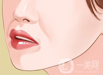 自體脂肪填充鼻唇溝怎么樣 能保持多久？