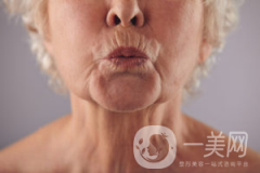 出現(xiàn)煙民線該如何解決呢？