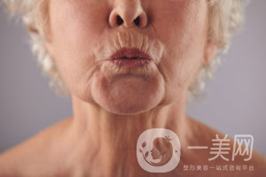 出現(xiàn)煙民線該如何調(diào)節(jié)呢？