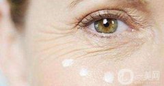 眼角除皺手術(shù)多少錢 眼角除皺的方法