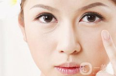 淚溝填充消腫需要多長時間？