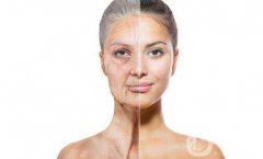 *和玻尿酸的區(qū)別是什么？