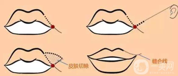 標準的仰月唇女明星有哪些？其中還有AB的整容模板！