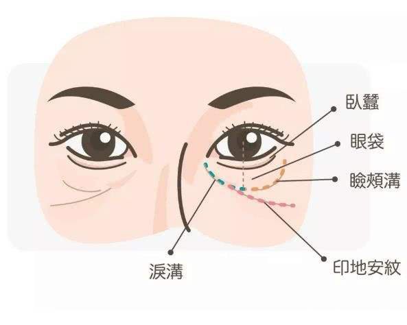 淚勾填充多少錢呢 哪些因素影響淚溝價(jià)格
