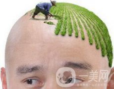 頭發(fā)種植術(shù)多少錢?如何判斷?