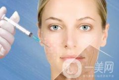 注射瘦臉除皺價格多少呢?費用詳解