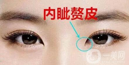 開內外眼角的區(qū)別,開內眼角,開外眼角