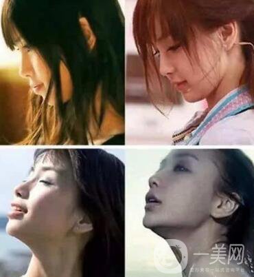 有沒有可能Angelababy不做整容手術(shù)就改變了這么多？