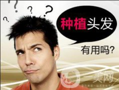 植發(fā)的危害有什么?優(yōu)點(diǎn)和價格介紹?
