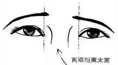 開眼角疼嗎？這幾種情況開眼角*果堪比換頭！