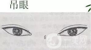 開眼角疼嗎？這幾種情況開眼角*果堪比換頭！