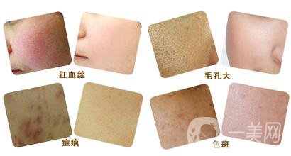彩光嫩膚好嗎？*果如何？