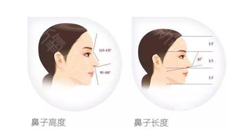 *手術(shù)過(guò)程 *手術(shù)多少錢
