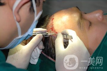 植發(fā)費(fèi)用多少錢(qián) 價(jià)格高不高？