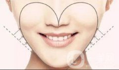 脂肪填充臉能維持幾年？