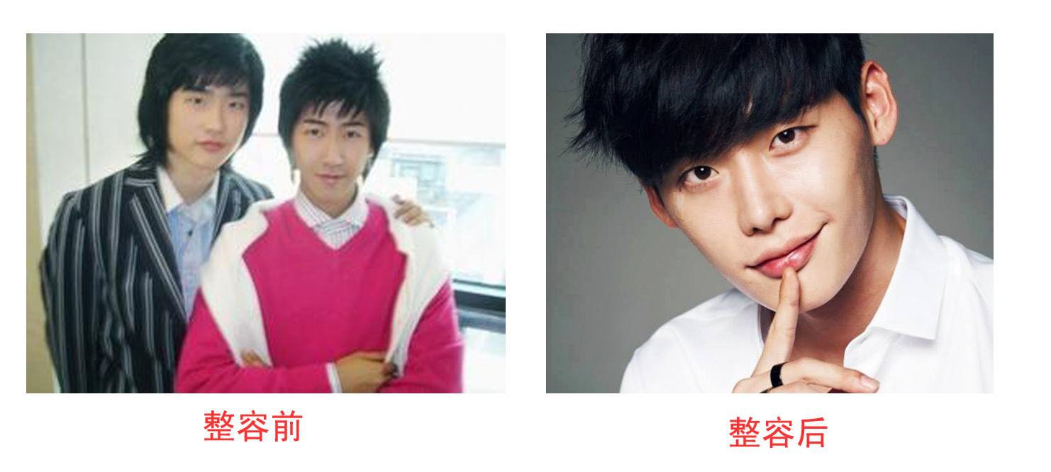 李鐘碩承認整容：李鐘碩整容前后照片