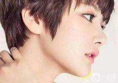 脂肪墊下巴好嗎 恢復時間是多久