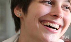 整形手術(shù)能讓你看起來年輕多少？